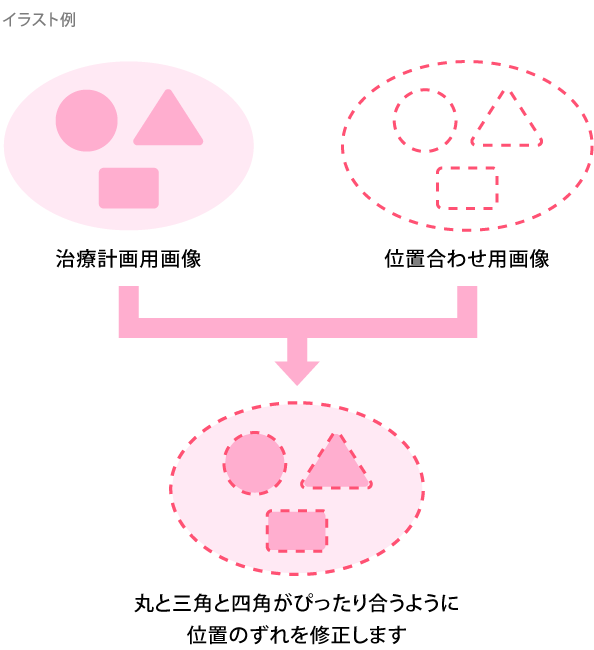 IGRTとは