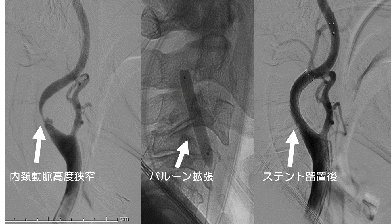 （図2）